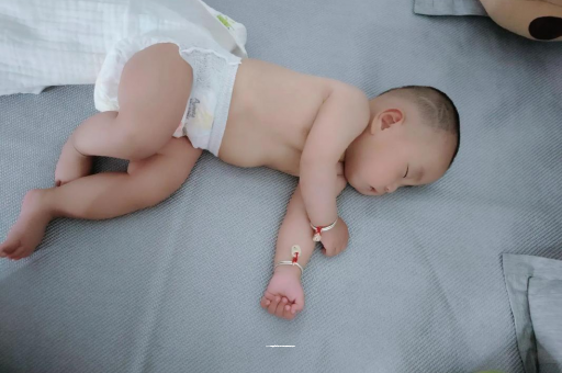 诸城六个月宝宝眼睛散光